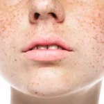 Les effets du soleil