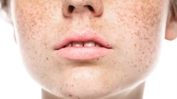 Les effets du soleil